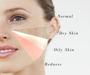 Know your skin/ Guide to diagnose your skin type